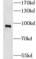 CNGA3 Antibody - BSA Free