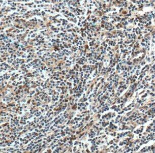 CMIP Antibody - BSA Free