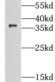 CLYBL Antibody - BSA Free