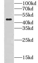 CLN3 Antibody - BSA Free