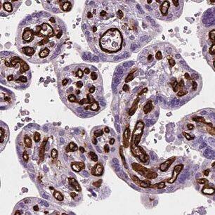 CLIC3 Antibody - BSA Free