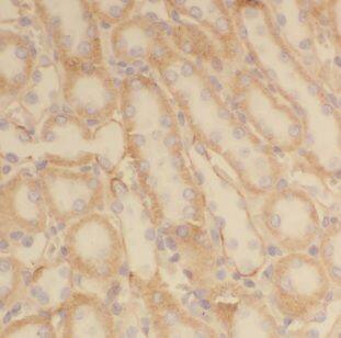 CLCNKA Antibody - BSA Free