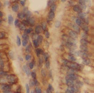 CLCA2 Antibody - BSA Free