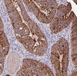 Claudin-23 Antibody - BSA Free