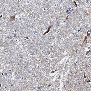 CHURC1 Antibody - BSA Free