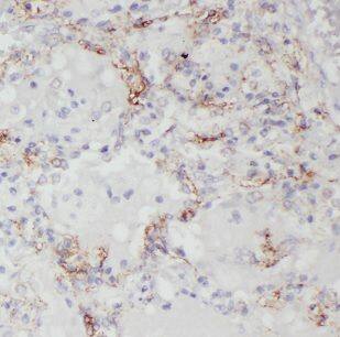CHSY1 Antibody - BSA Free