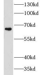 CHSY1 Antibody - BSA Free