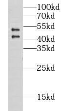 CHST9 Antibody - BSA Free