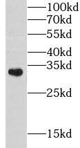 CHST8 Antibody - BSA Free