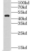 CHST14 Antibody - BSA Free