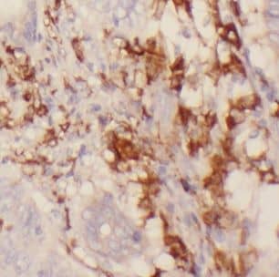 CHST12 Antibody - BSA Free