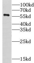 Carbohydrate Sulfotransferase 10/CHST10 Antibody - BSA Free