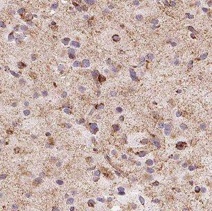 Carbohydrate Sulfotransferase 10/CHST10 Antibody - BSA Free