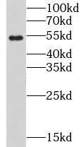 Nicotinic Acetylcholine Receptor beta Antibody - BSA Free