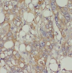 Nicotinic Acetylcholine Receptor beta Antibody - BSA Free