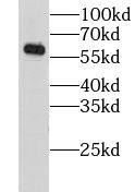 Nicotinic Acetylcholine R alpha 6/CHRNA6 Antibody - BSA Free