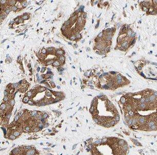 Nicotinic Acetylcholine R alpha 3/CHRNA3 Antibody - BSA Free