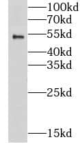 Nicotinic Acetylcholine R alpha 1/CHRNA1 Antibody - BSA Free