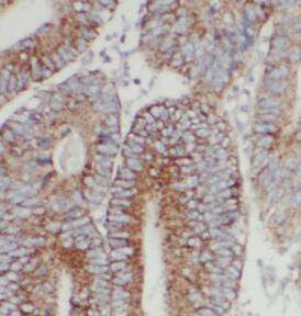 CHSS2 Antibody - N-terminal - BSA Free