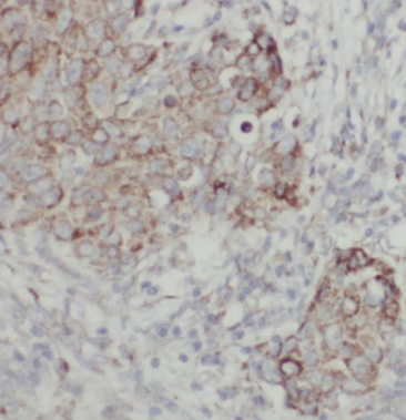 Choline kinase alpha Antibody - BSA Free