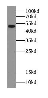 Choline kinase alpha Antibody - BSA Free