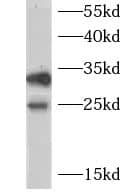 CHMP1a Antibody - BSA Free