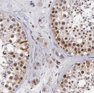 CHMP1a Antibody - BSA Free