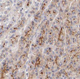 Choline dehydrogenase Antibody - BSA Free