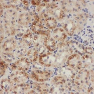 CHD9 Antibody - BSA Free