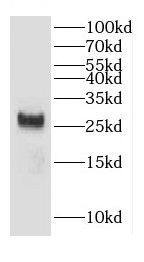 CHCHD6 Antibody - BSA Free