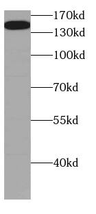 CGNL1 Antibody - BSA Free
