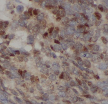 CGNL1 Antibody - BSA Free