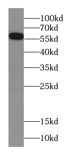 CES7 Antibody - BSA Free