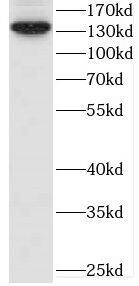 CEP97 Antibody - BSA Free
