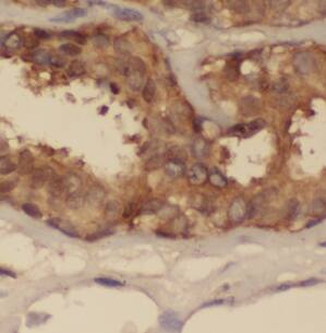 CEP97 Antibody - BSA Free