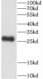CEP70 Antibody - BSA Free