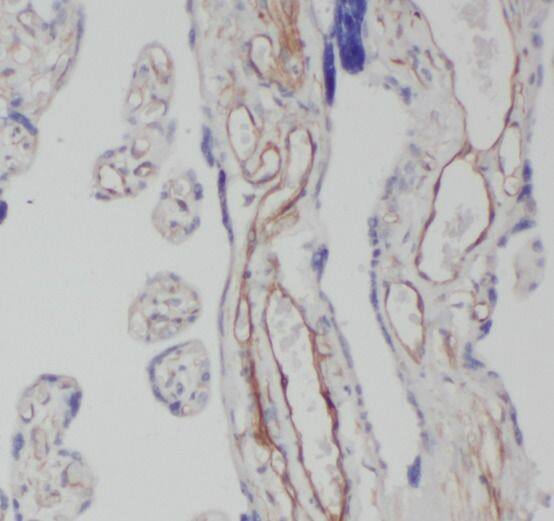 CEP290 Antibody - BSA Free