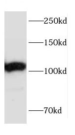 CEP152 Antibody - BSA Free