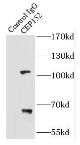 CEP152 Antibody - BSA Free