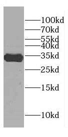 CENPP Antibody - BSA Free