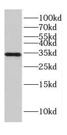 CENPO Antibody - BSA Free