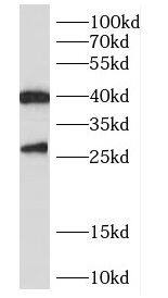 CENPN Antibody - BSA Free