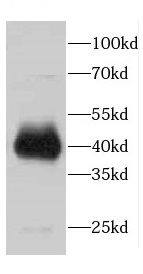 CDCA7 Antibody - BSA Free
