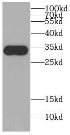 CDCA4 Antibody - BSA Free