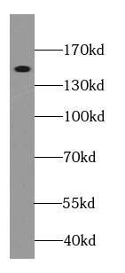 Integrin alpha D/CD11d Antibody - BSA Free