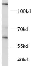 CCT6B Antibody - BSA Free