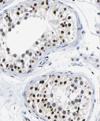 CCHCR1 Antibody - BSA Free