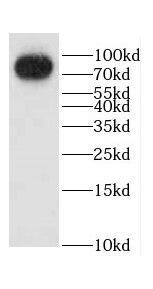 CCHCR1 Antibody - BSA Free