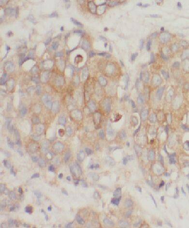 CCDC99 Antibody - BSA Free
