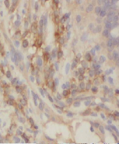 CCDC93 Antibody - BSA Free